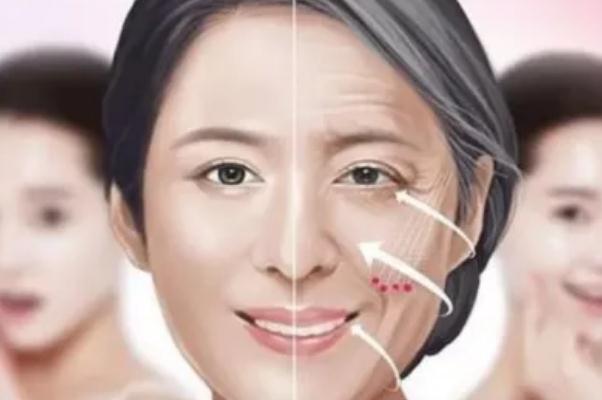 拉皮手术要做几个小时 拉皮手术要涂几个月疤痕膏